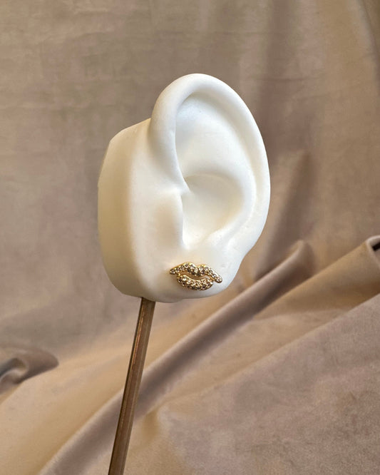 Arete Beso